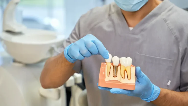 Quem tem perda óssea pode fazer implante de dente